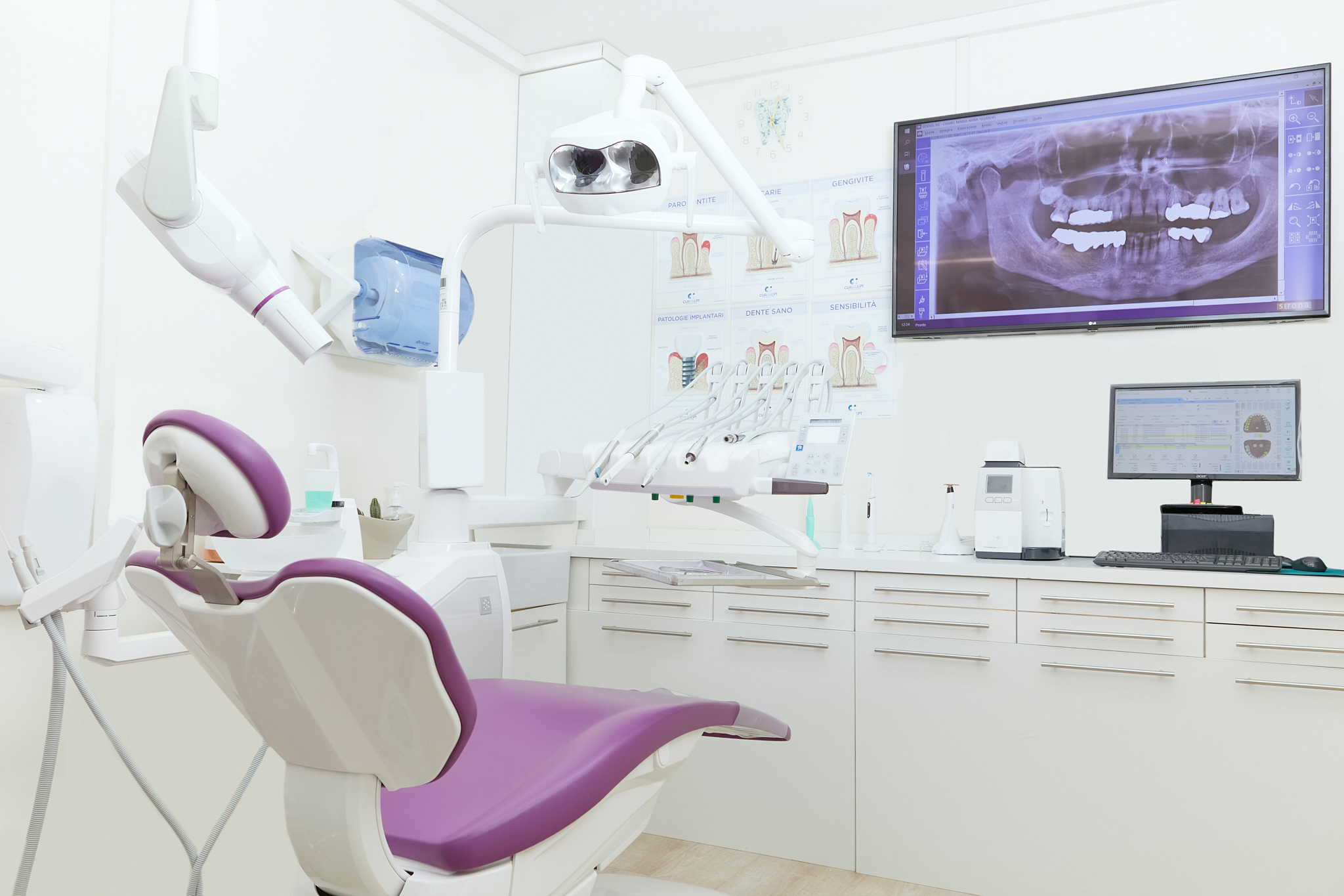 studio dentistico tg dental roma dentista finocchio borghesiana gnatologia ortopanoramica poltrona